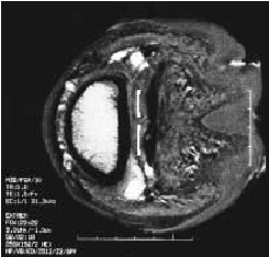 Image /tmp/lyx_tmpdir32021QpDzgJ/lyx_tmpbuf0/_home_glenn_work_phd_writing_seminar_transverse-mri.png